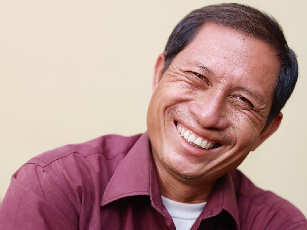 All-on-4 Denture