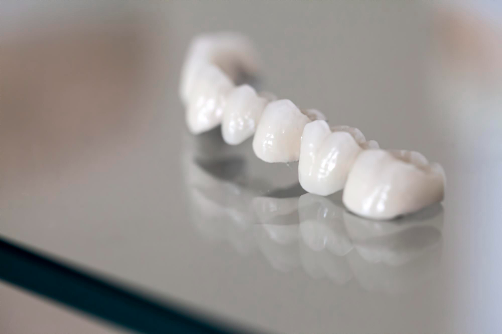 Porcelain Crowns (Caps)